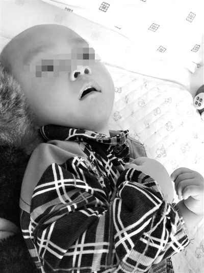 9月10日，陳揚(yáng)躺在醫(yī)院的病床上，他的眼睛仍然沒(méi)有聚焦感。新京報(bào)記者 朱柳笛 攝