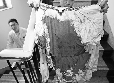 何女士的上衣被血浸透。記者楊濤攝