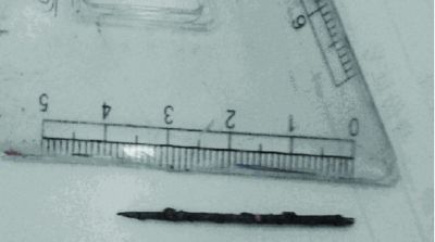 取出的繡花針已發(fā)黑生銹。