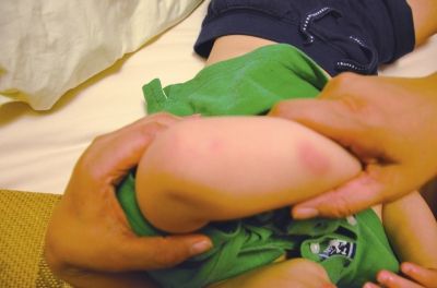 孩子身上有多處明顯傷痕。京華時(shí)報(bào)讀者供圖