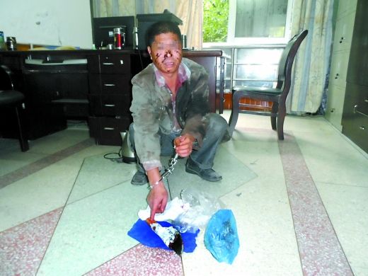   目前張遠已被刑事拘留。