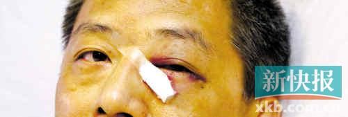 ■這起醫(yī)鬧事件，受傷的遠(yuǎn)遠(yuǎn)不只是熊旭明醫(yī)生的身體。