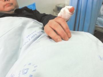 實(shí)習(xí)醫(yī)生陳洪左手的小拇指肌腱斷裂。