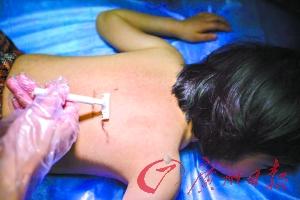 9歲女童得怪病 因服用廉價(jià)激素藥物致全身長(zhǎng)毛 9歲女童得怪病 因服用廉價(jià)激素藥物致全身長(zhǎng)毛