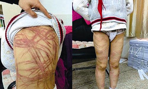 南京虐童案養(yǎng)母致歉:將用加倍關(guān)愛(ài)彌補(bǔ)過(guò)失 南京虐童案養(yǎng)母致歉:將用加倍關(guān)愛(ài)彌補(bǔ)過(guò)失