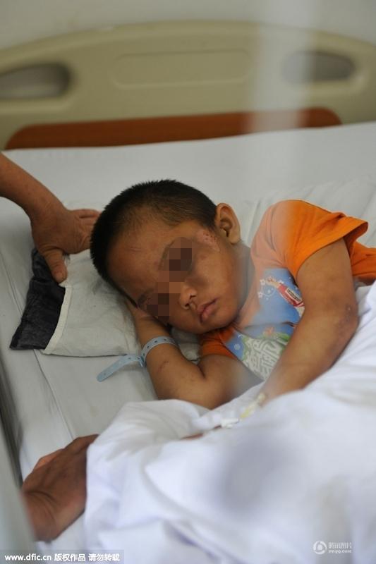 圖為全身傷痕累累的小進。