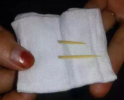 腳后跟拔出的牙簽 腳后跟拔出的牙簽