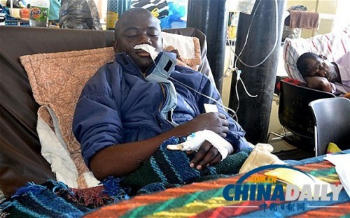 雖然已經(jīng)在醫(yī)院接受了近一個月的恢復治療，卡托卡的身體仍然非常虛弱。