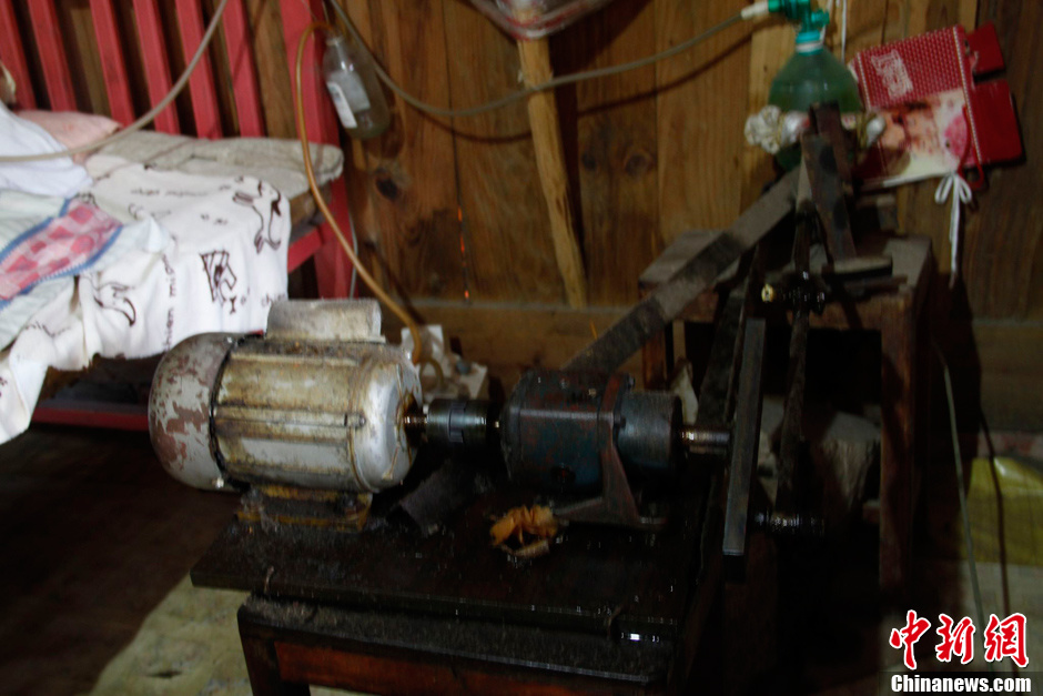 父母為癱瘓兒子自制呼吸機(jī) 手捏呼吸球5年不輟 父母為癱瘓兒子自制呼吸機(jī) 手捏呼吸球5年不輟