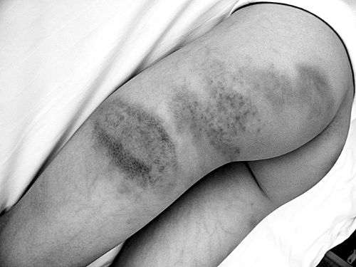 老師持掃帚打?qū)W生30分鐘 一個班20個同學(xué)被打過 老師持掃帚打?qū)W生30分鐘 一個班20個同學(xué)被打過