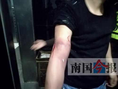 覃先生手臂被卡的部位受傷流血，所幸傷勢無大礙。 通訊員 王建民 攝