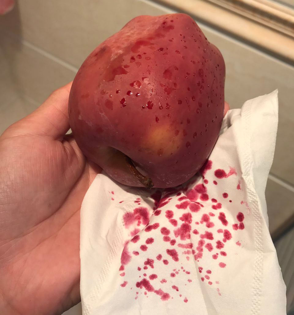 嚇懵！女子用熱水泡蘋果結(jié)果冒出血珠 咋回事？