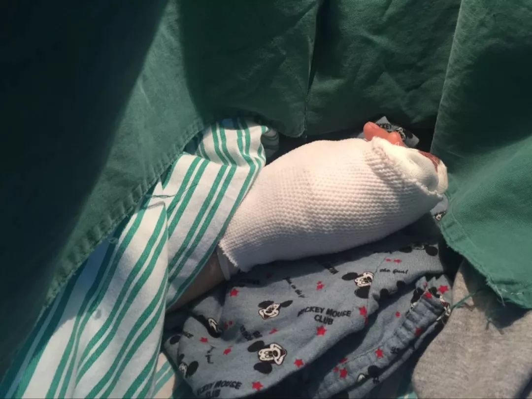 嚇哭！6歲男孩被夾斷手指 罪魁禍?zhǔn)拙故切７? oldsrc=