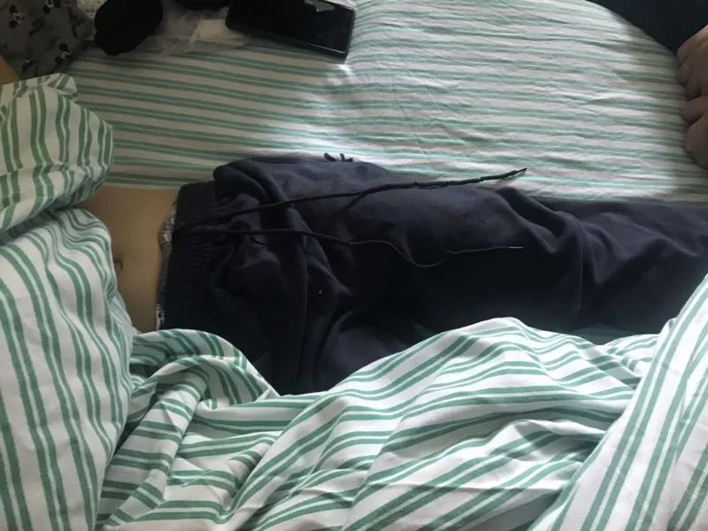 嚇哭！6歲男孩被夾斷手指 罪魁禍?zhǔn)拙故切７? oldsrc=