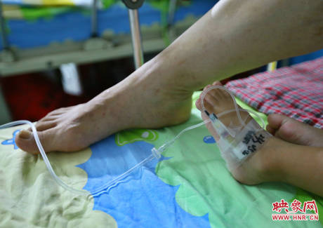 駐馬店失明雙胞胎手術(shù)成功 駐馬店失明雙胞胎手術(shù)成功