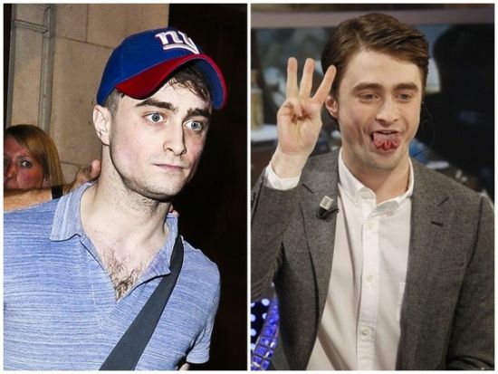 丹尼爾日前被拍到骨瘦如柴，不似2月份健康