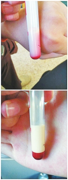 信陽嬰兒患怪病血液呈乳白色 求助權(quán)威機(jī)構(gòu)查病因遭拒 信陽嬰兒患怪病血液呈乳白色 求助權(quán)威機(jī)構(gòu)查病因遭拒