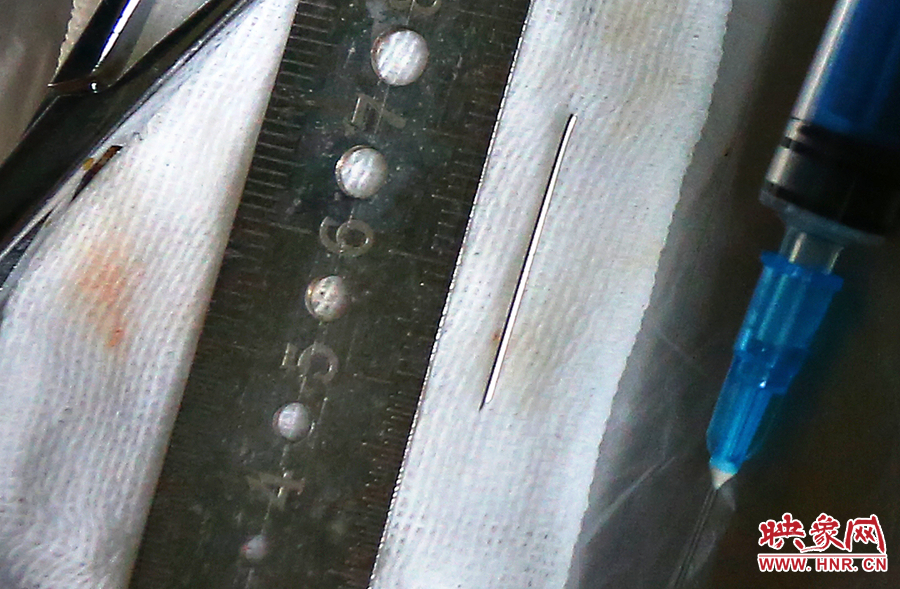 上午11點(diǎn)42分，大龍顱內(nèi)的鋼針被取出