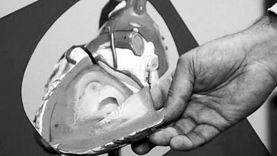 威廉斯領(lǐng)導的研究團隊已經(jīng)利用人體脂肪干細胞，成功3D打印出心臟血管和心臟瓣膜，待一顆心臟的所有部件打