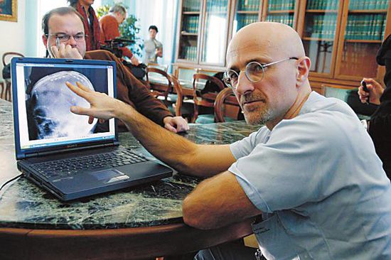 圖為卡納維洛醫(yī)生，不少人認(rèn)為他的想法非常瘋狂