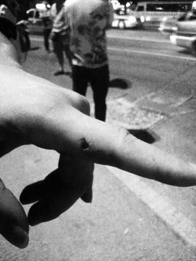 民警食指被咬傷。