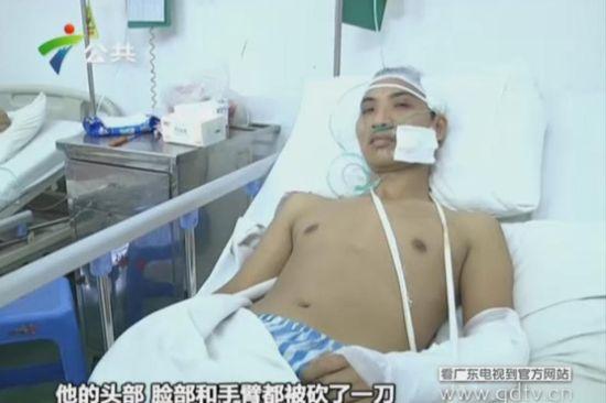 另一名傷者頭部、臉部和手臂都被砍了一刀。(視頻截圖)