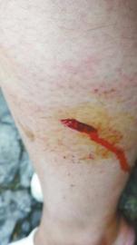 郭女士腿上被猴子咬的傷口。(受訪者供圖)