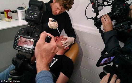 該實驗是由加州一支名為“生物駭客”的實驗團隊開展的。他們使用了一種名為二氫卟吩e6（Ce6）的物質(zhì)的溶液。Ce6常見于深海魚體內(nèi)，有光敏特性，通常用于癌癥治療研究中。研究團隊將Ce6與胰島素和鹽水混合起來，得到一種溶液，可以在低光照條件下提高人類的視力。