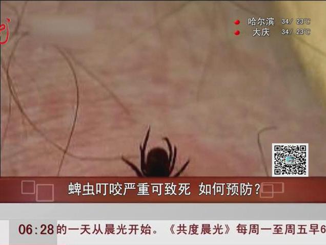 蜱蟲叮咬嚴(yán)重可致死如何預(yù)防？