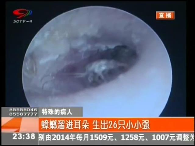 小強溜進耳朵？生26只小小強