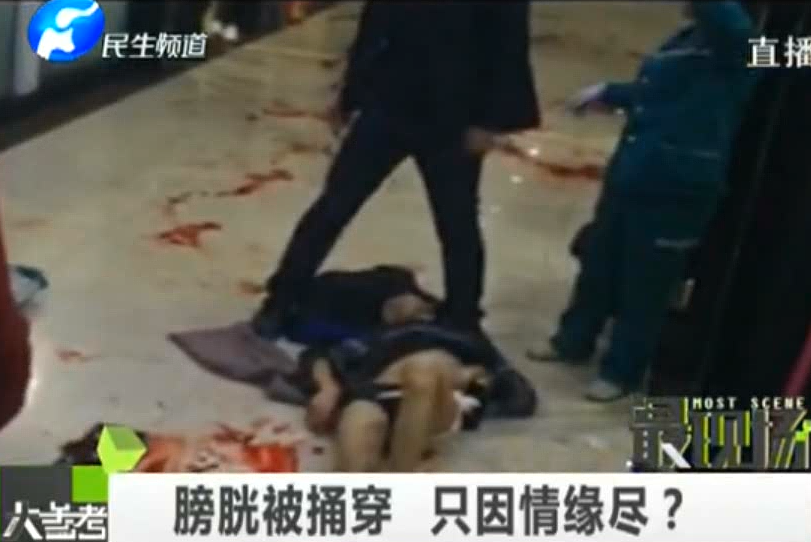 膀胱被捅穿 只因情緣盡？